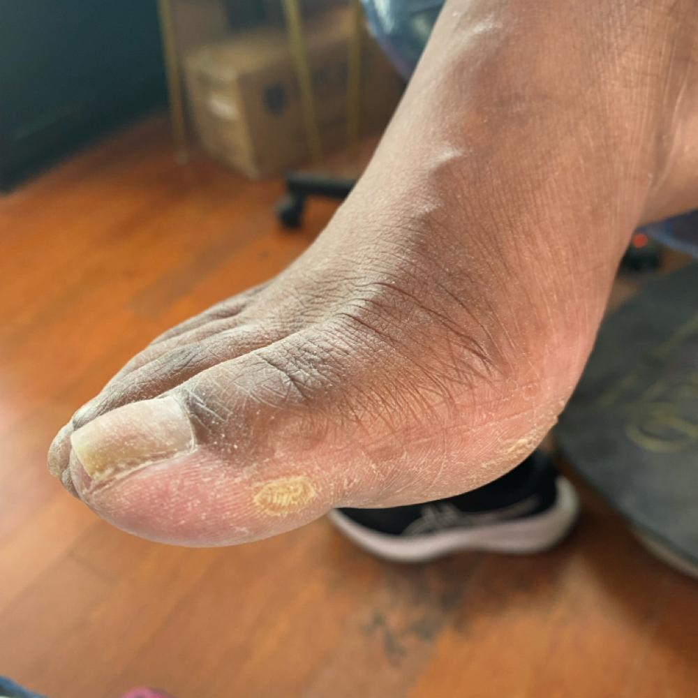 Waterless Pedicure-Stage 2 at Taylor’D Nailz in Ga, GA