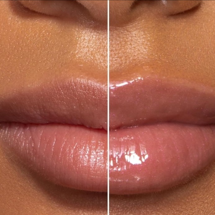 Lip Filler- Mini Plump at Glow Lab Aesthetics & Wellness in El Paso, TX