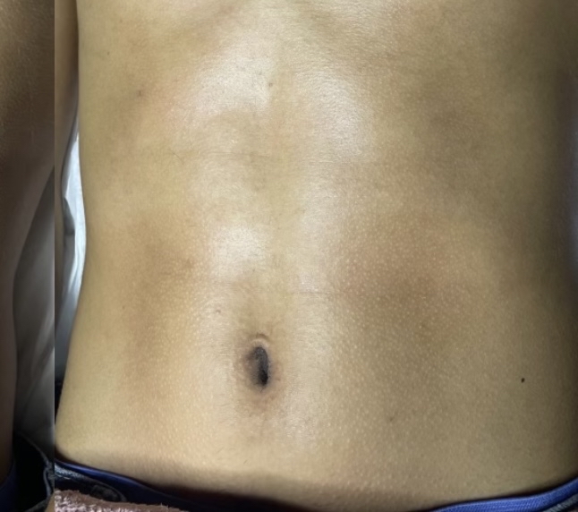 Mens Stomach Sugar Wax