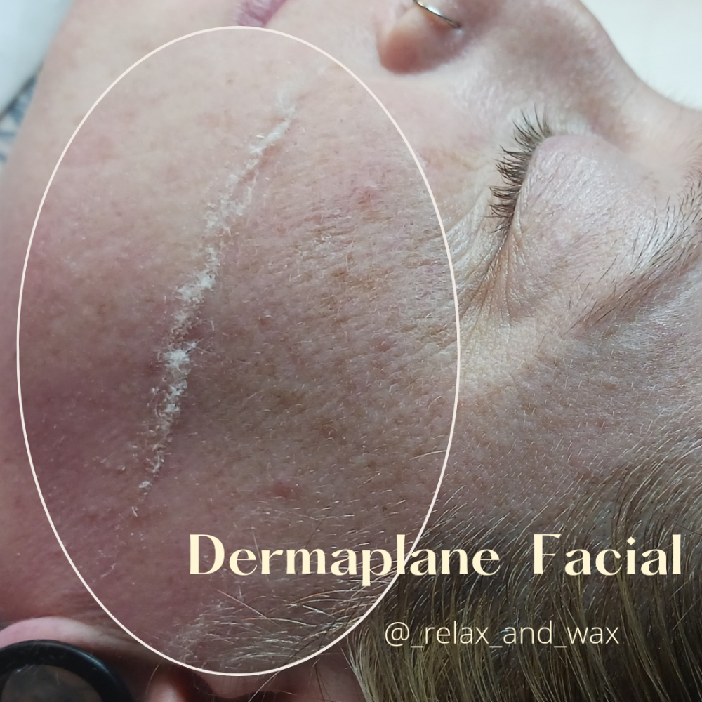 Exquisite Dermaplane Facial