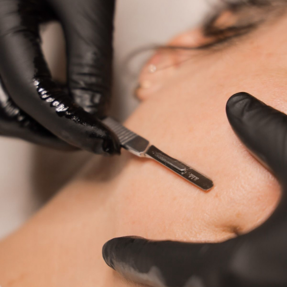 Dermaplanning Facial at RM SKINBAR AND SALON in Little Rock, AR