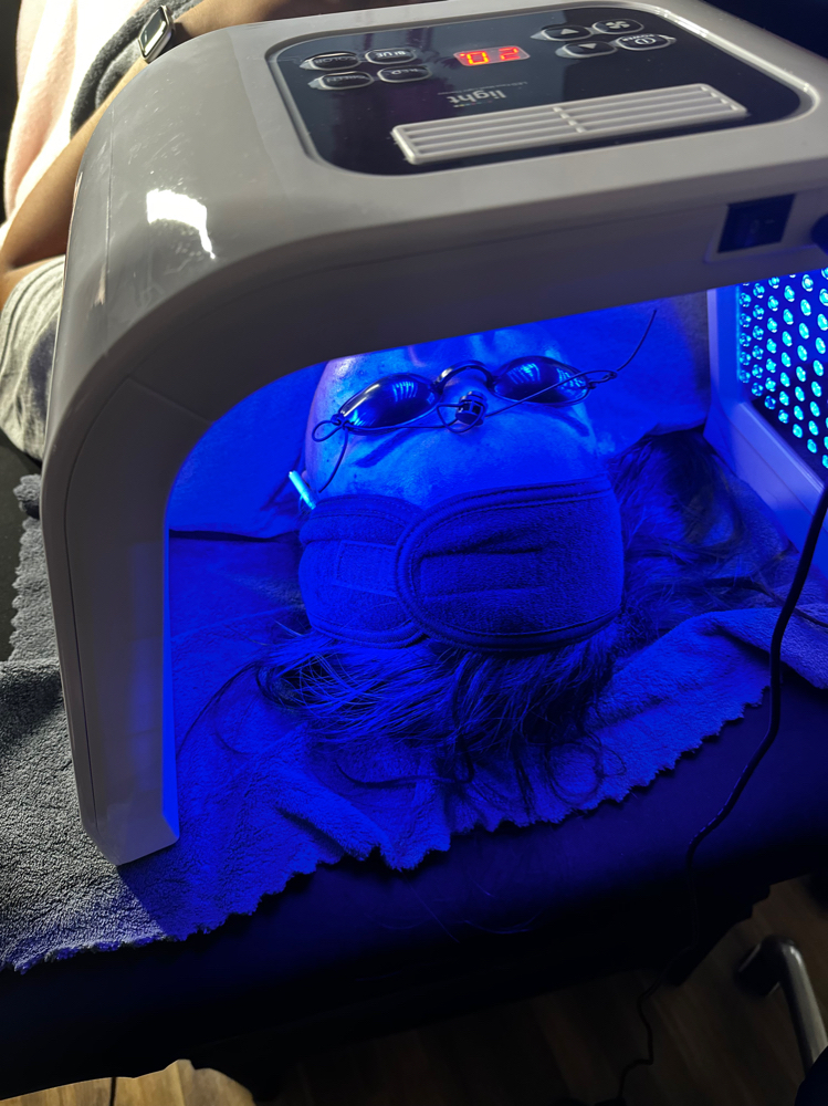 Acne Facial