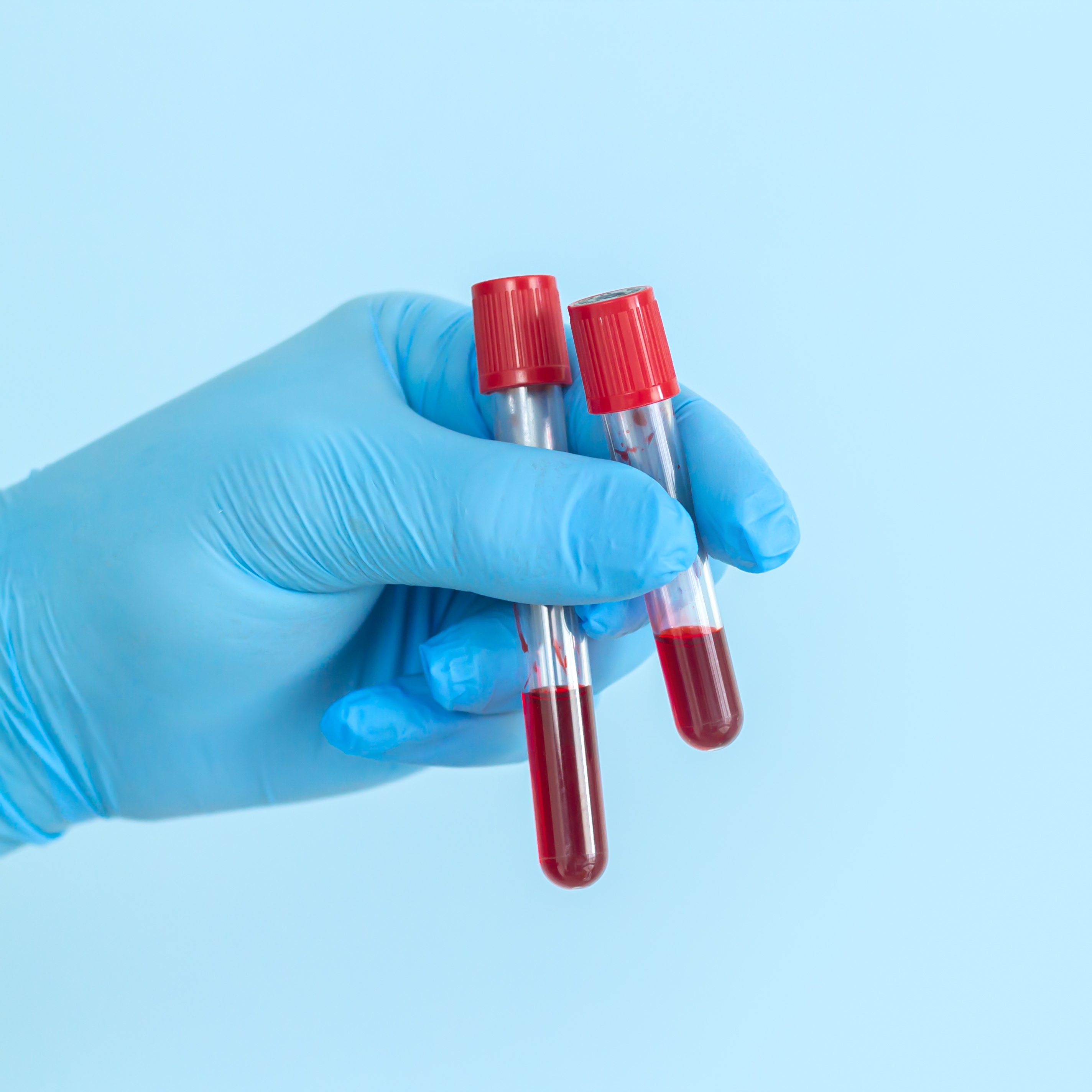 Methamphentamine Blood Test at Give-A-Little More Lab Services & more in HOUSTON, TX