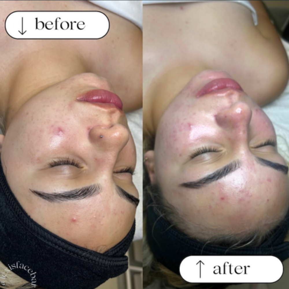 Custom Facial at Love Beauty Lounge in Victorville, CA