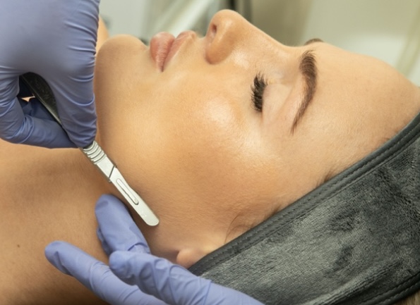 Dermaplaning With Enzyme Peel at Marina Novak in North Palm Beach, FL