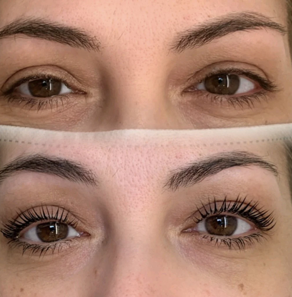 Lash Lift