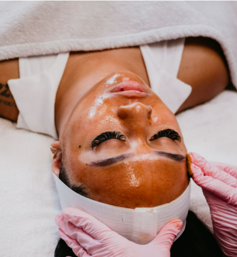 Chemical Peel - Pro