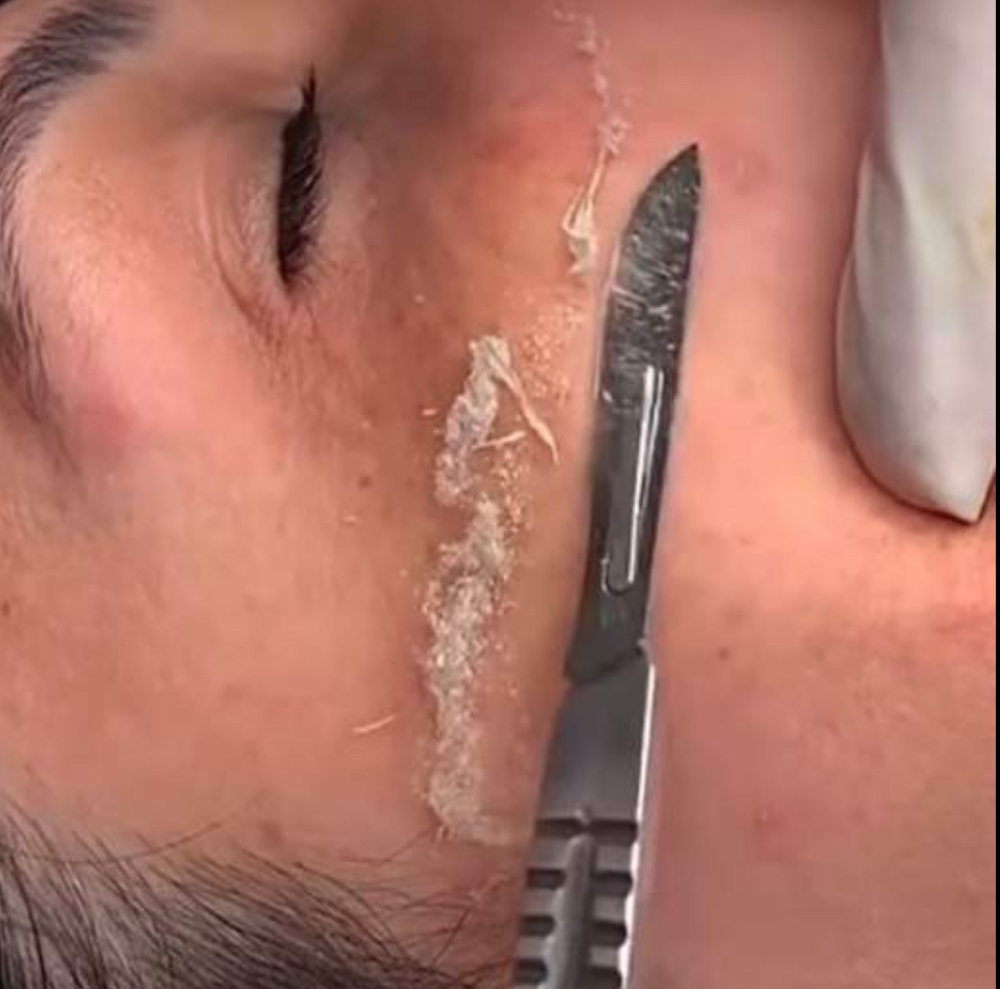 Dermaplaning Facial