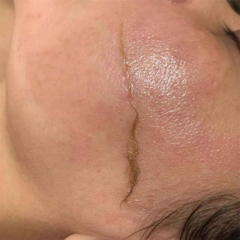 The Dermaplane Facial