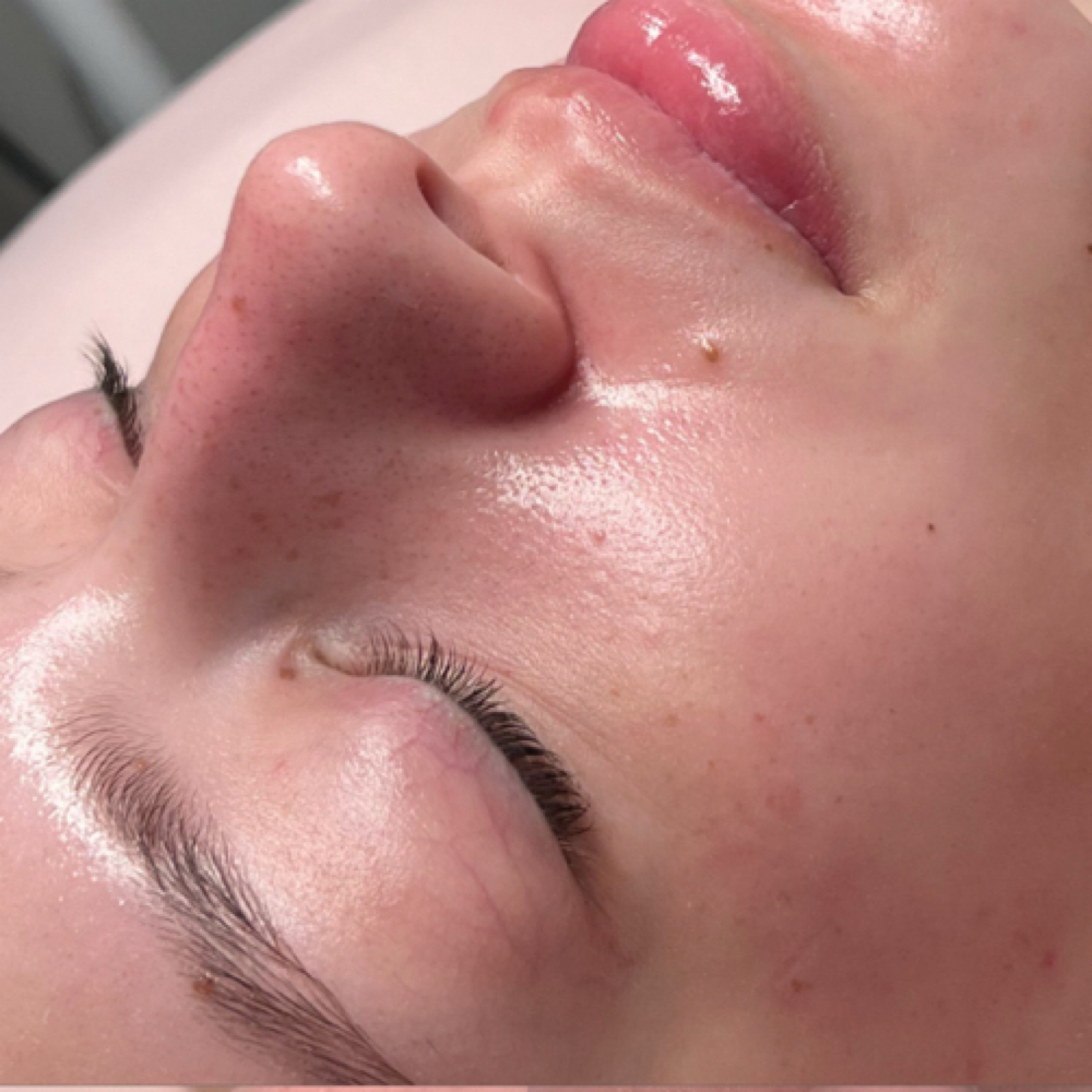 HydroGlow Facial at Elite Beauty And Beyond in Worth, IL