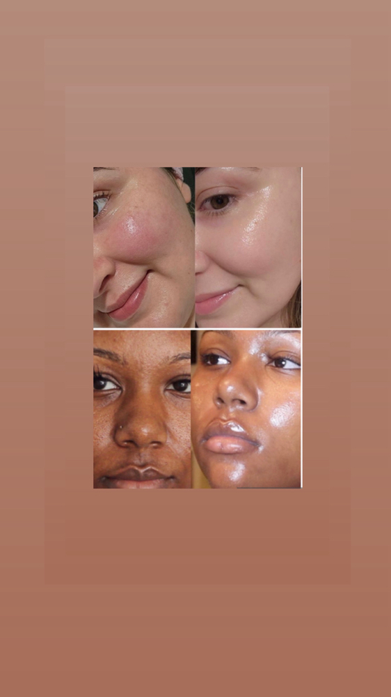 Even Tone Women’s Facial Series