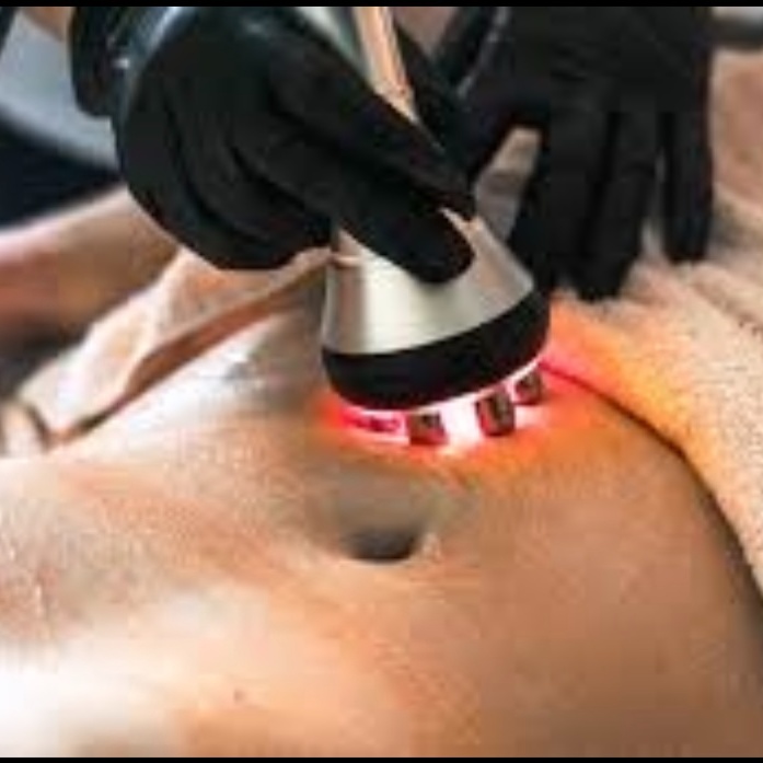Radiofrequency- Skin Tightening