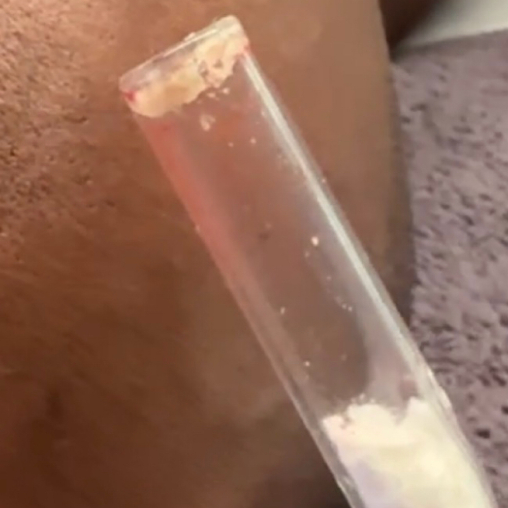 Deep Cleanse at Essence Aesthetics Wellness Suite LLC in Troy, NY