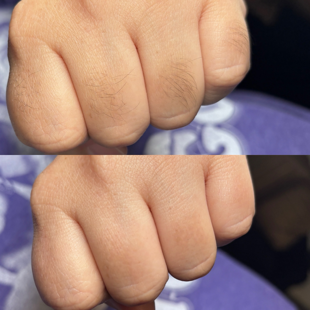 Fingers