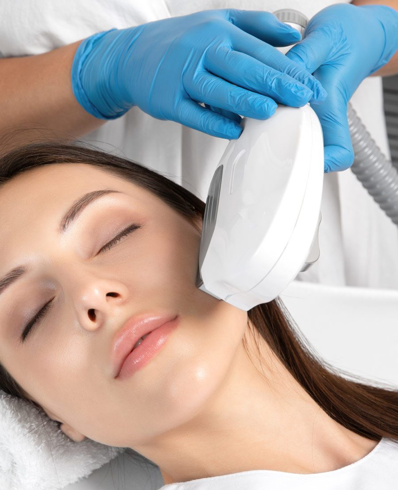 IPL Photo facial