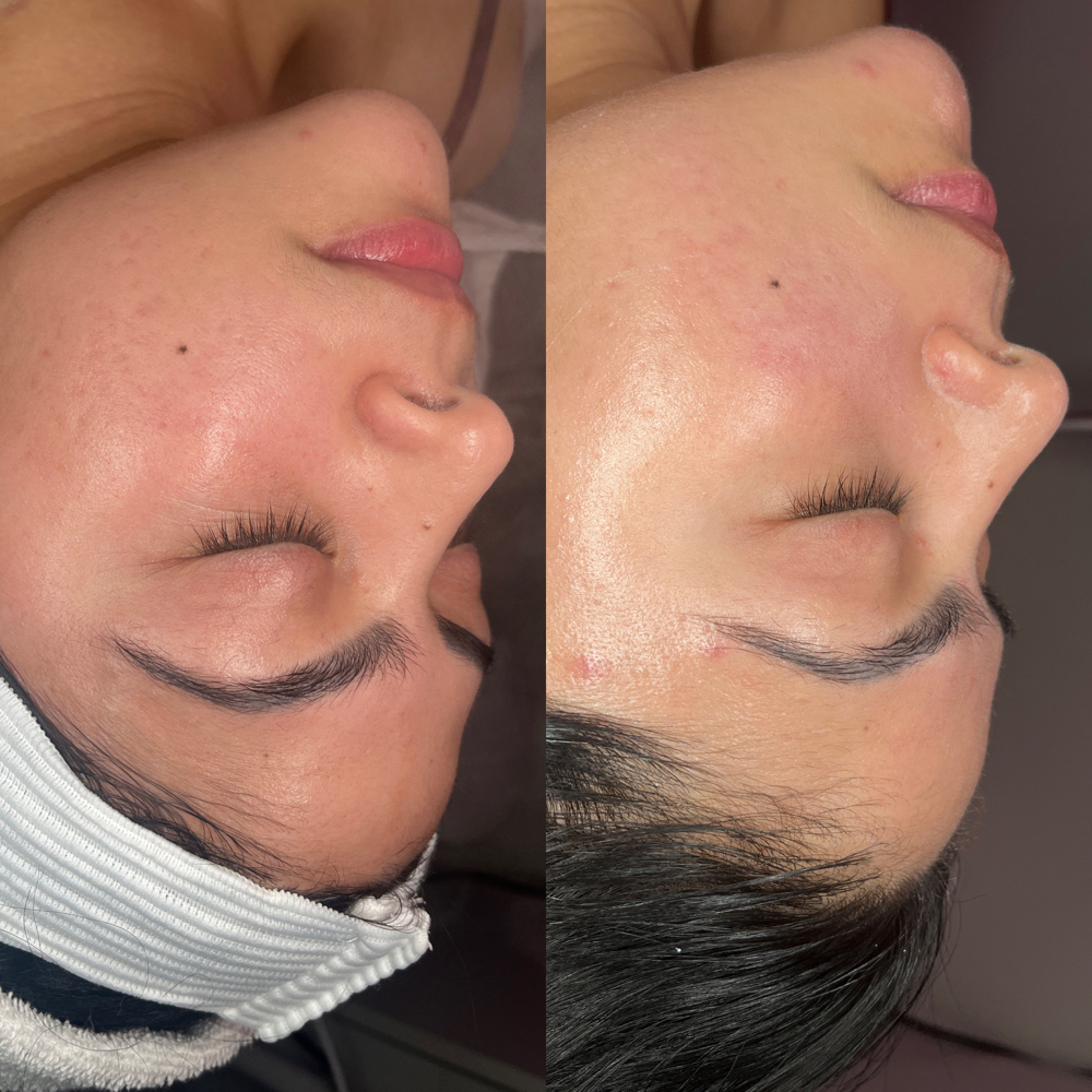 Brightening facial