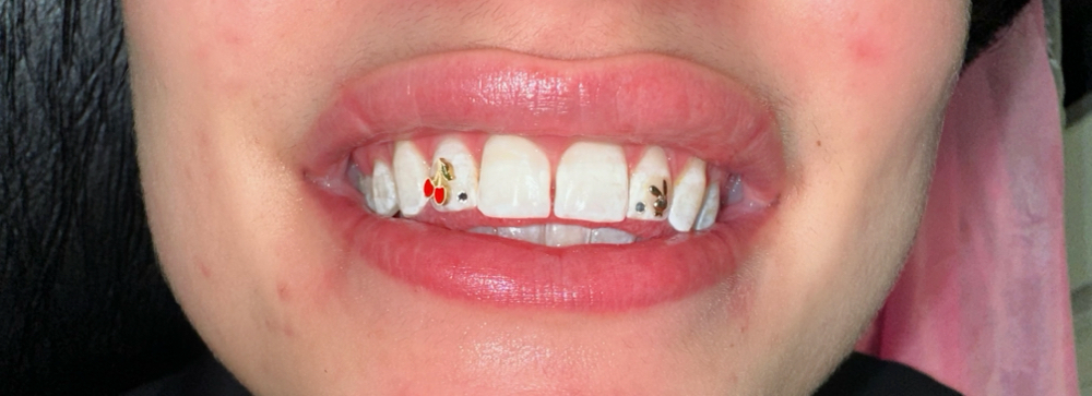 🆕 CHERRY COUPE [KANDY PAINT]™