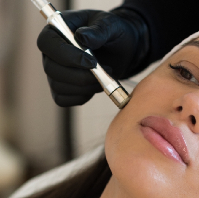 Diamond Tip Microdermabrasion