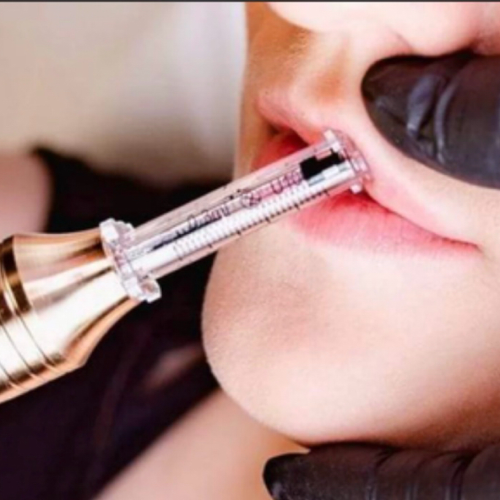 Lip Filler 1ml at Mermaid Riot in Lockbourne, OH