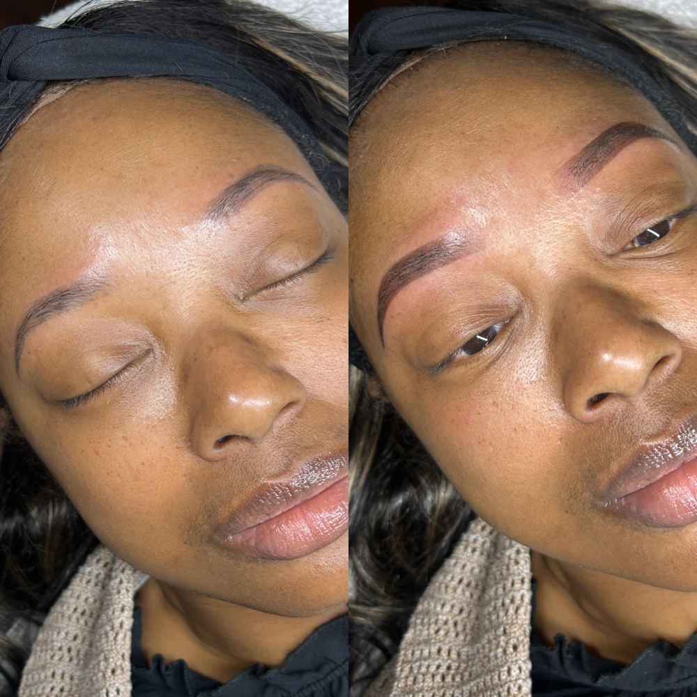 Free In Person Consultation(Micro)