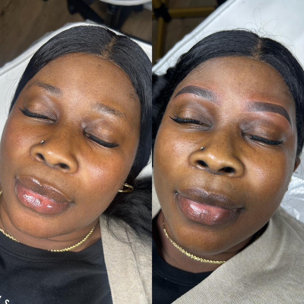 Free In Person Consultation(Micro)
