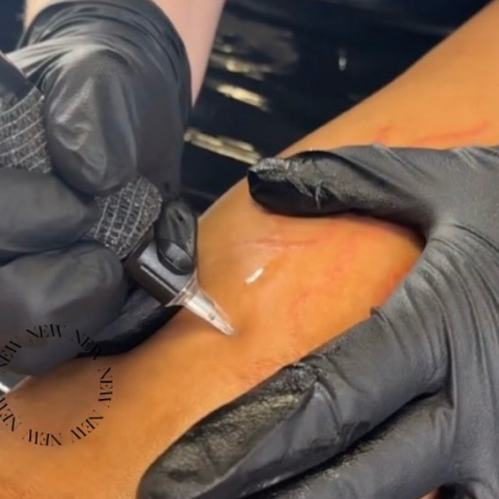 8 Week Paramedical Touchup at Rain Spa in Rhinebeck, NY