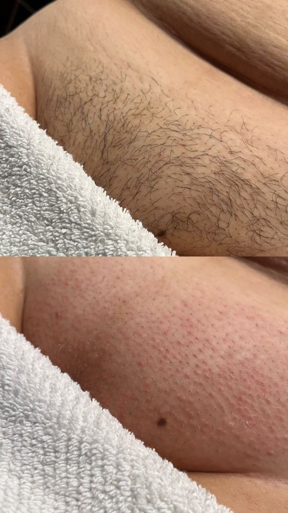 FULL Body Wax