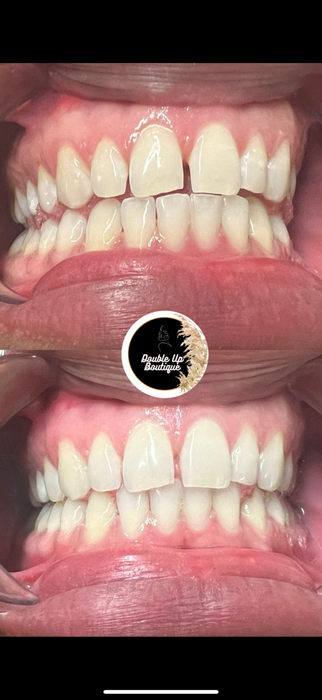 60 Minute Teeth Whitening at Double Up Boutique in Warwick, RI