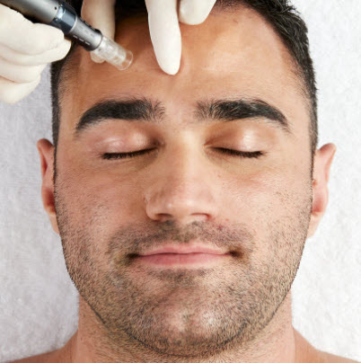 Mens Facial (by Referral Only)