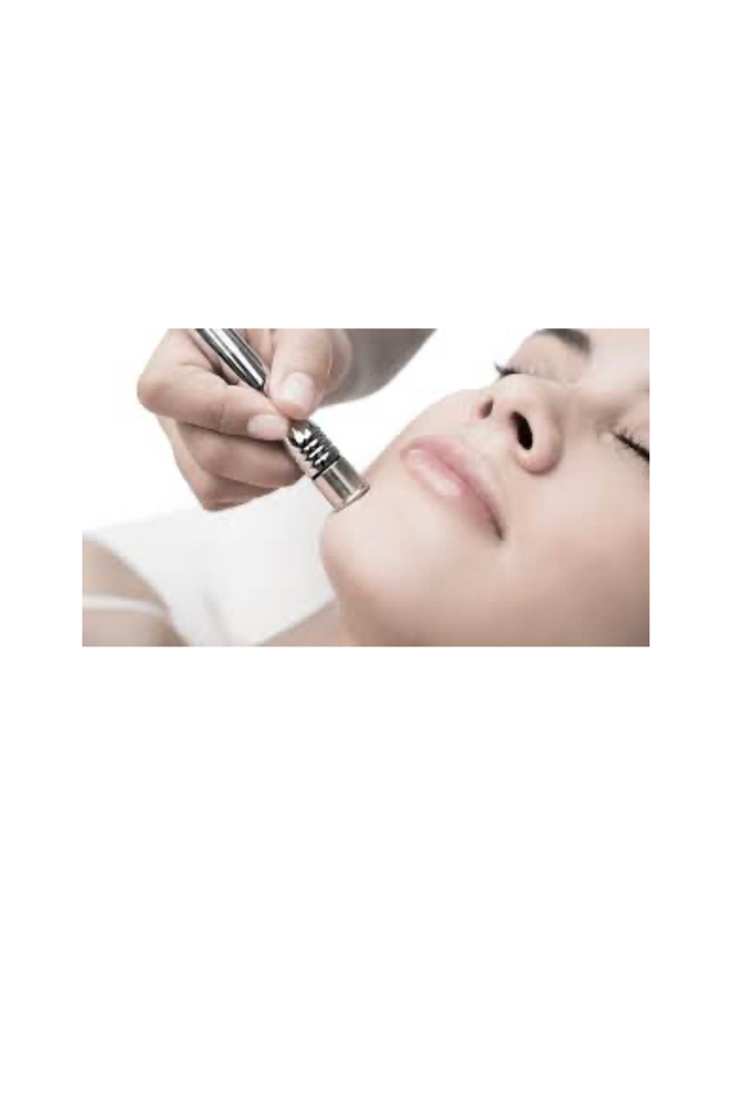 Microdermabrasion