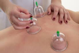 Medi Cupping Massage Add On