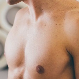 Performance Acne Chest/shoulders at THE MED BAR in Colorado, CO