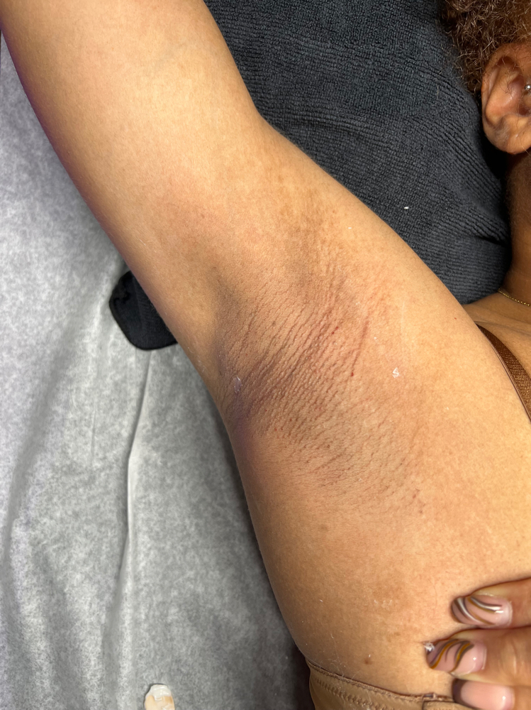 Underarm Wax