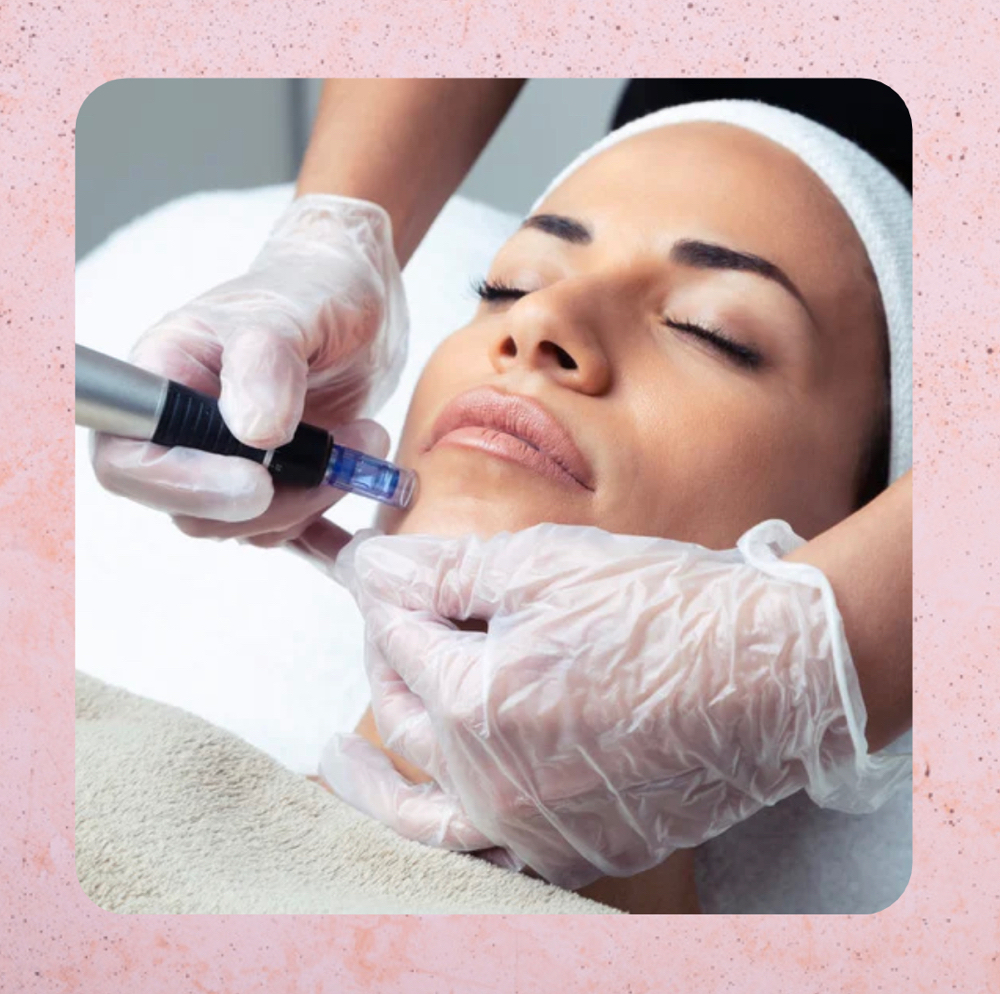 Micro-needling Glow Facial