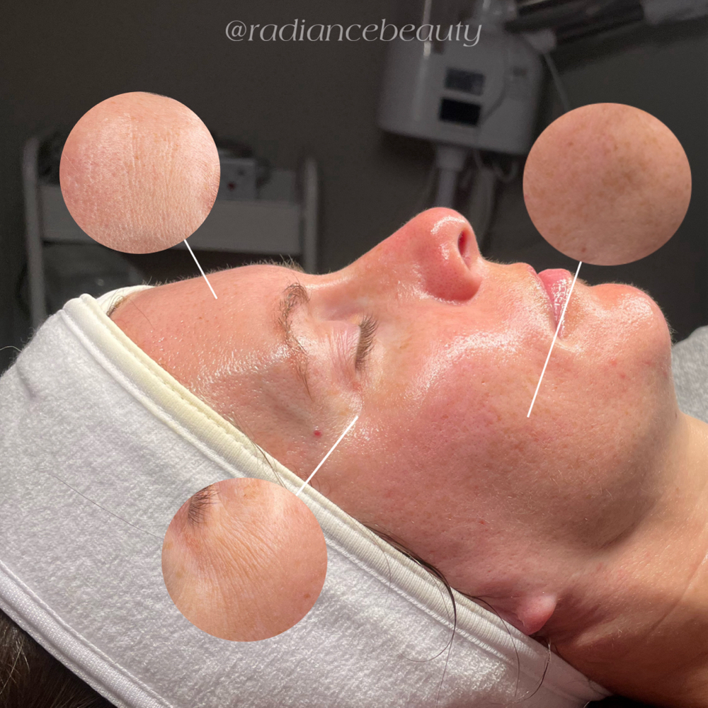 Youthful Treatment