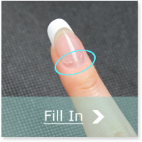 Nail Fill