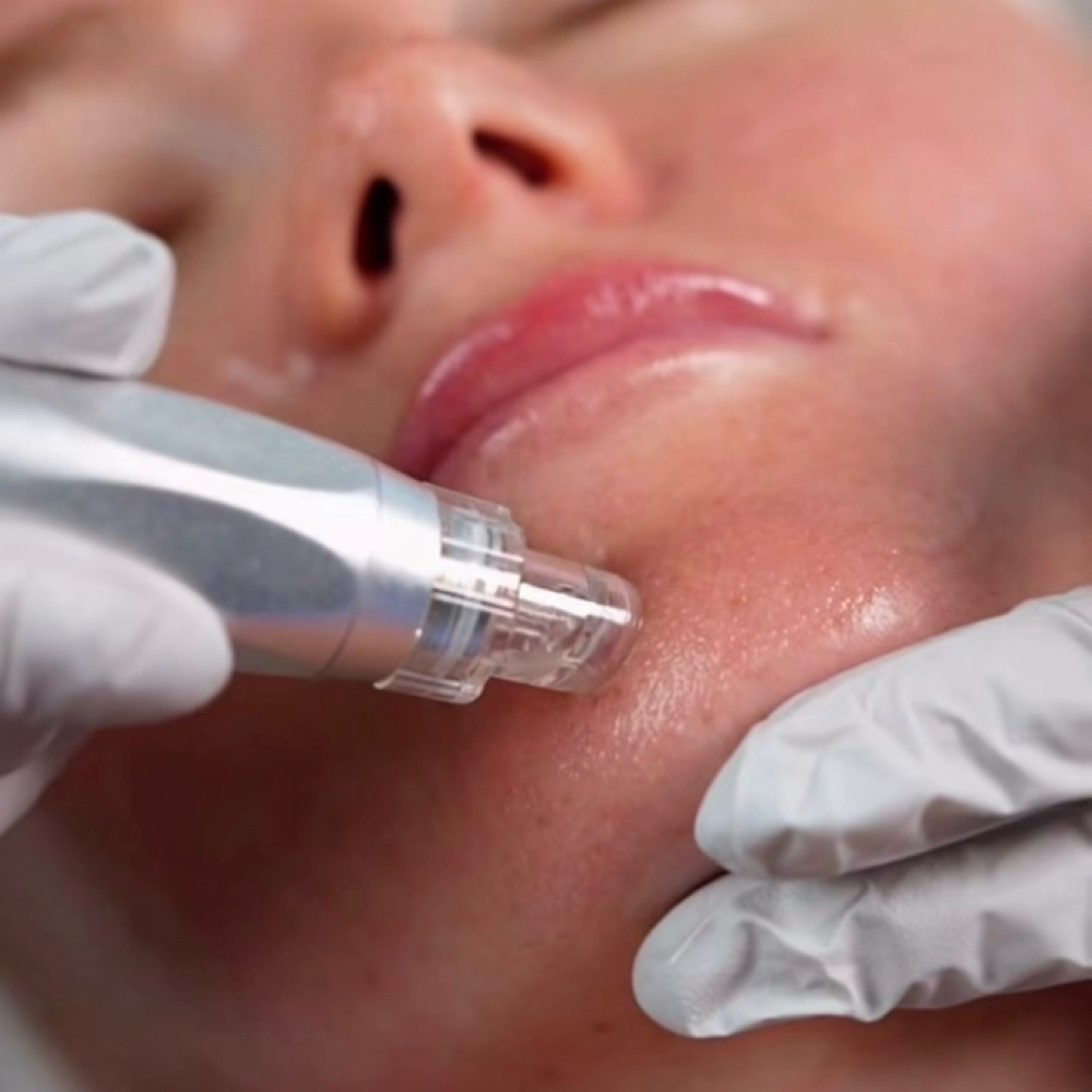 Hydro Dermoabrasion Pro at HandSpa Body & Face LLC in East Brunswick, NJ