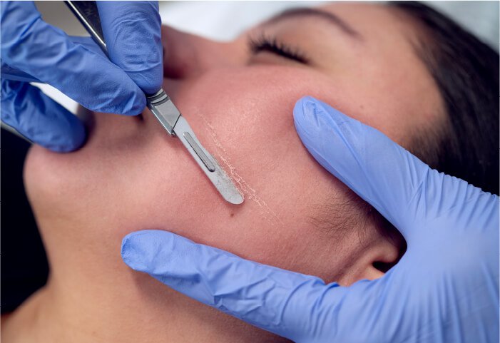 Dermaplaning Facial