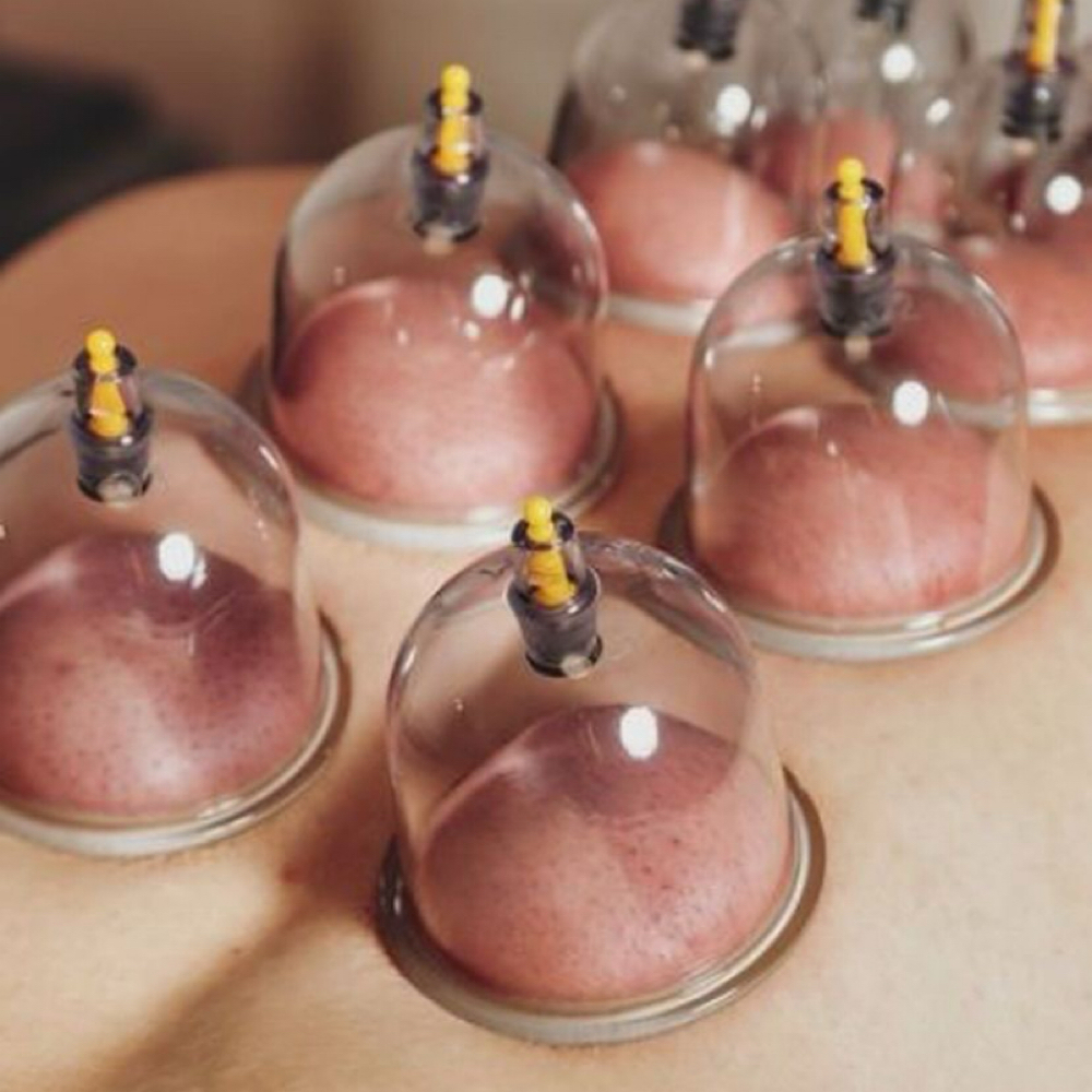 Cupping Add On at Knead From Within Massage in Klamath Falls, OR