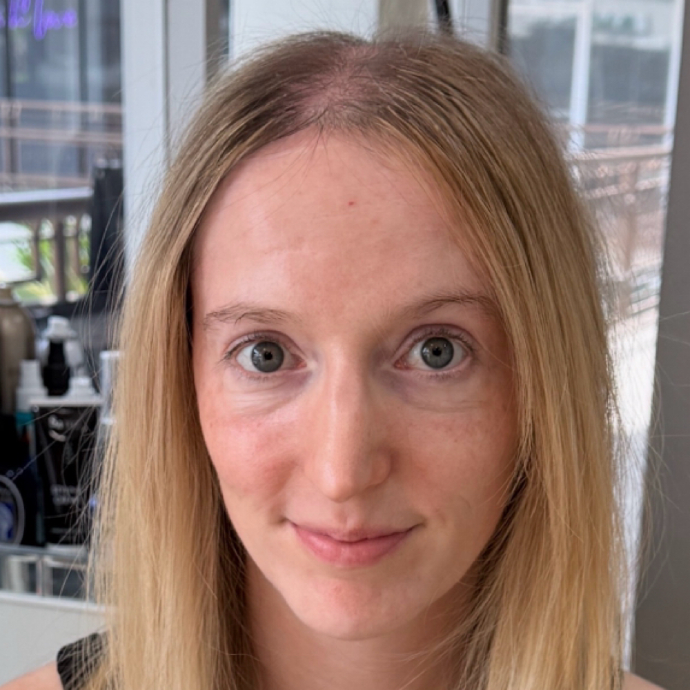 Hair Loss / Thinning Hair Solutions at Vered Salon in West Hollywood, CA