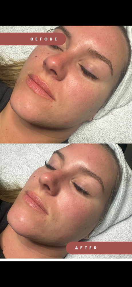 Signature Enzyme Facial