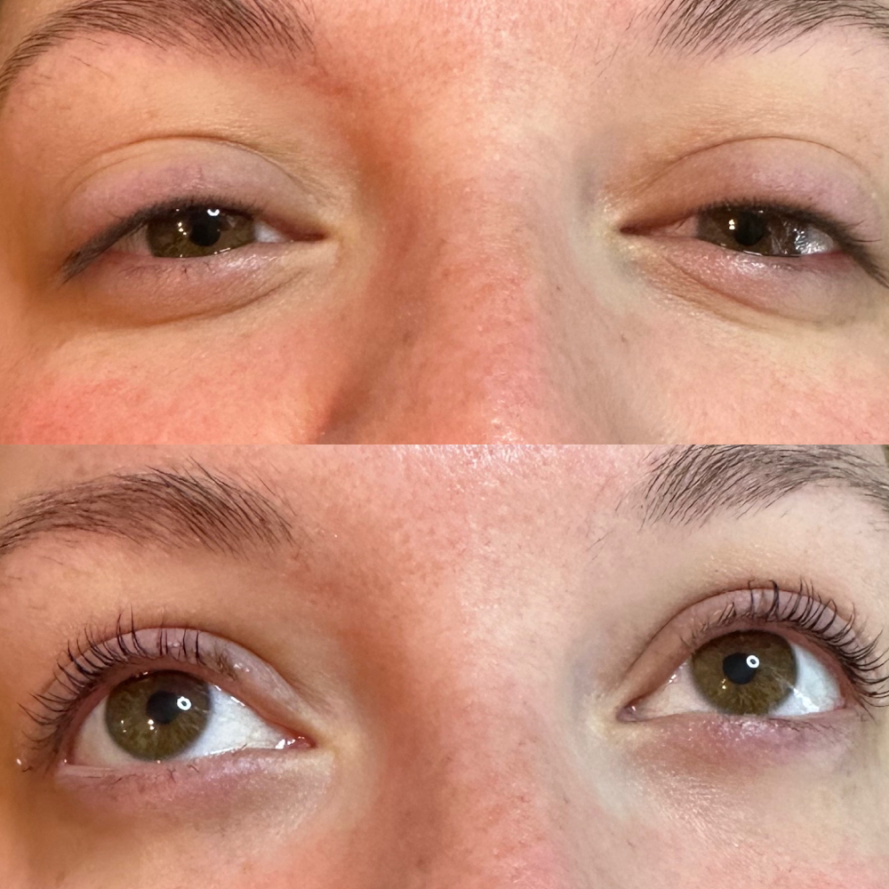 Eyelash Lift