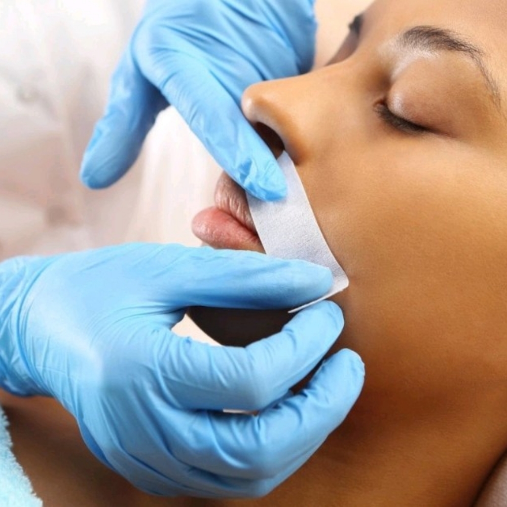 Upper Lip at Merritt Aesthetics in Rochester, NY