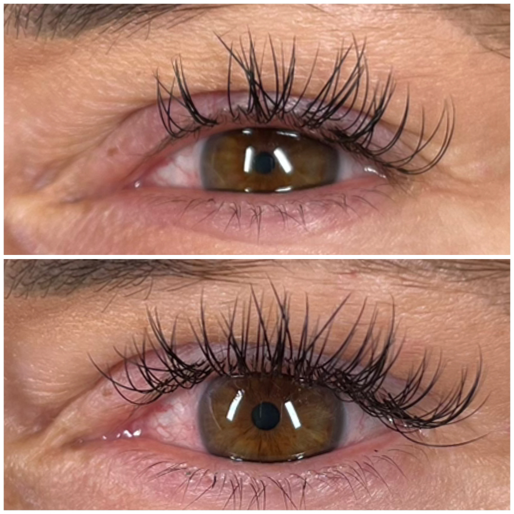 2 Weeks Classic Refill