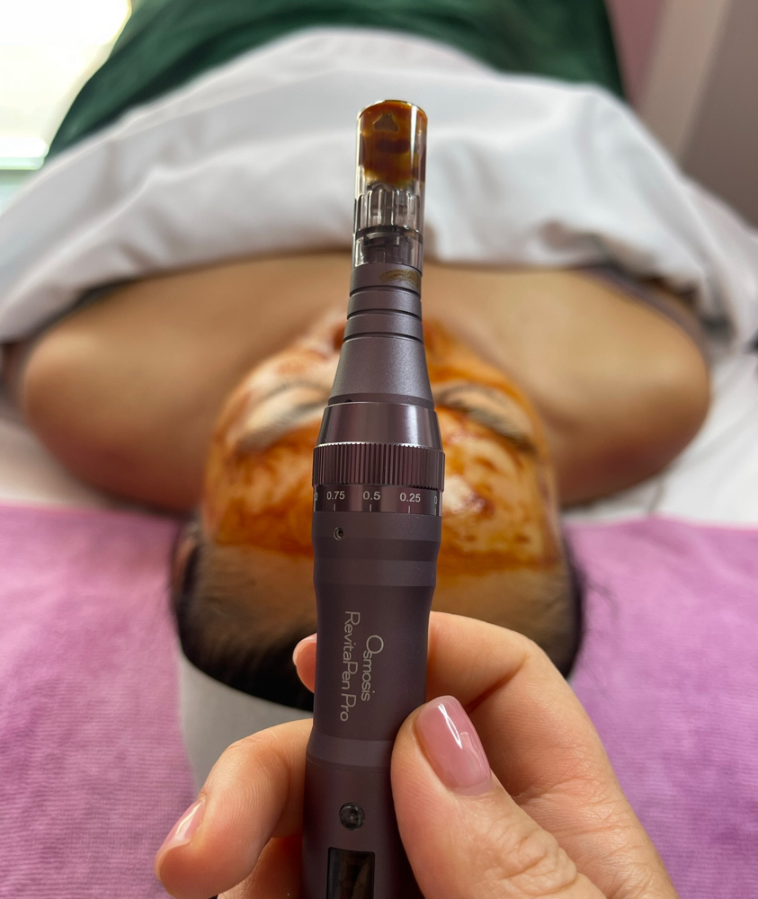 Facial Infusion deluxe treatment