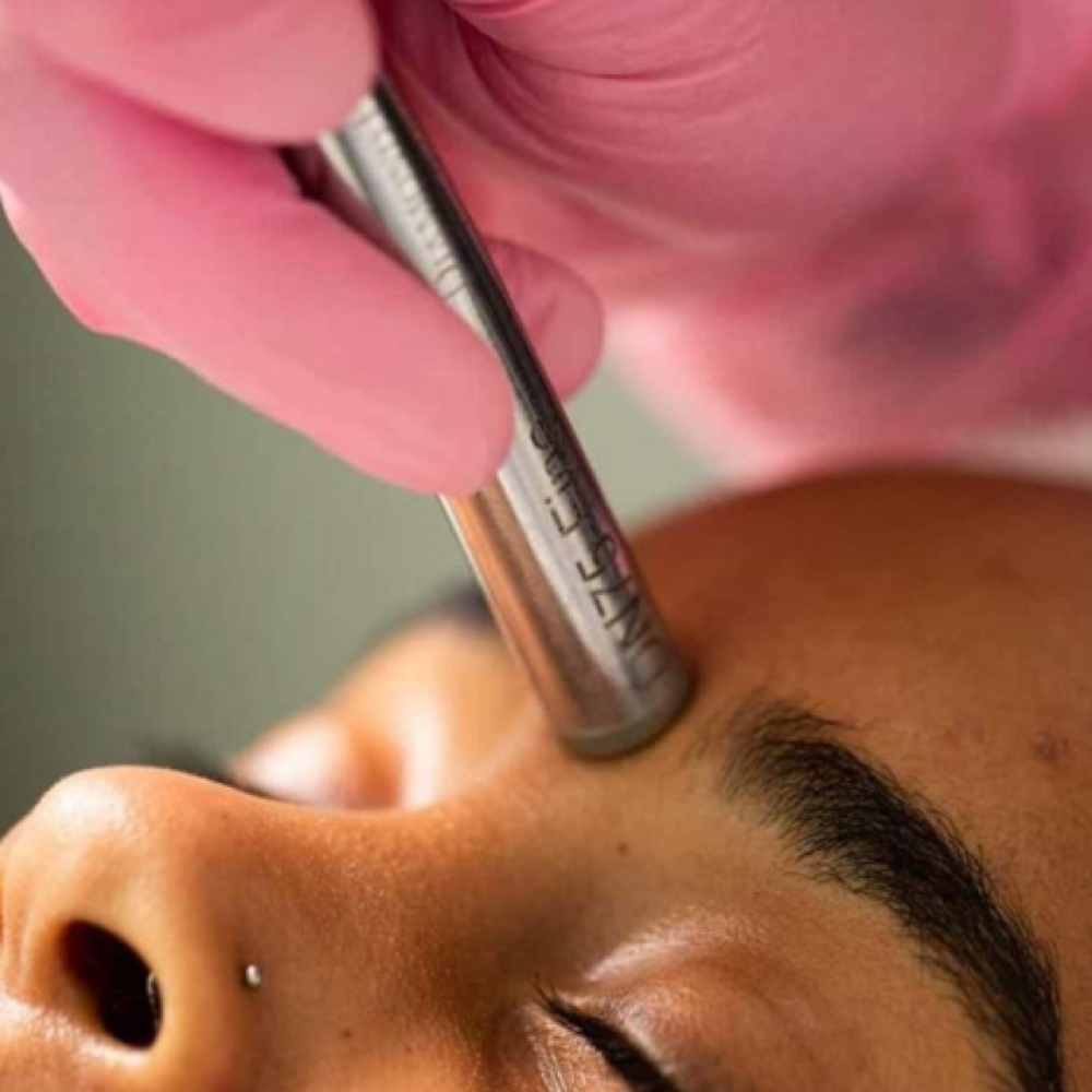 Microdermabrasion Treatment at AC SKIN STUDIO in Knoxville, TN
