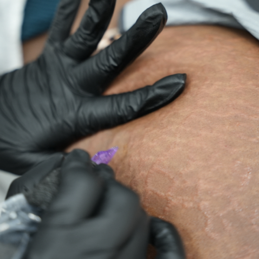 Medical Tattooing at Revive Wellness in El Paso, TX