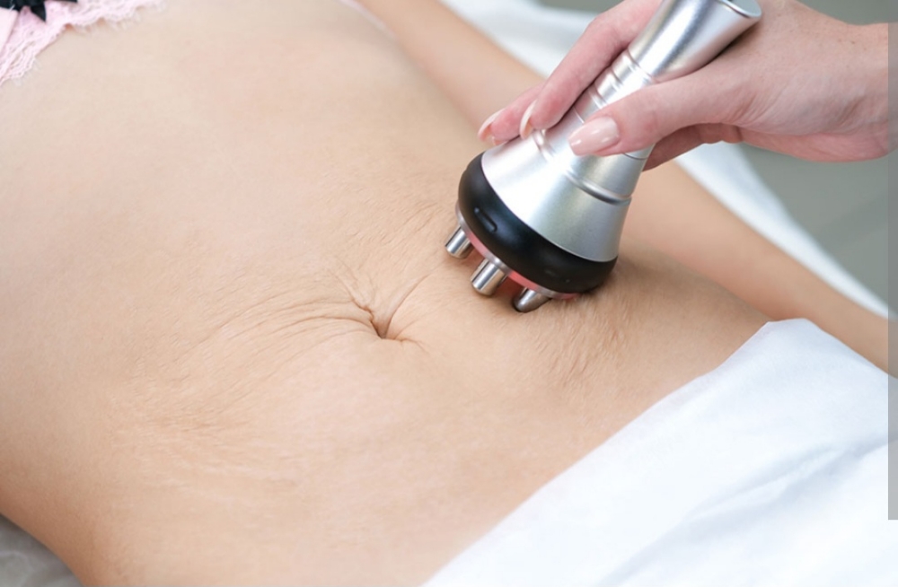 Glow + Tight RF Lift at Renue Spa And Wellness in Joliet, IL