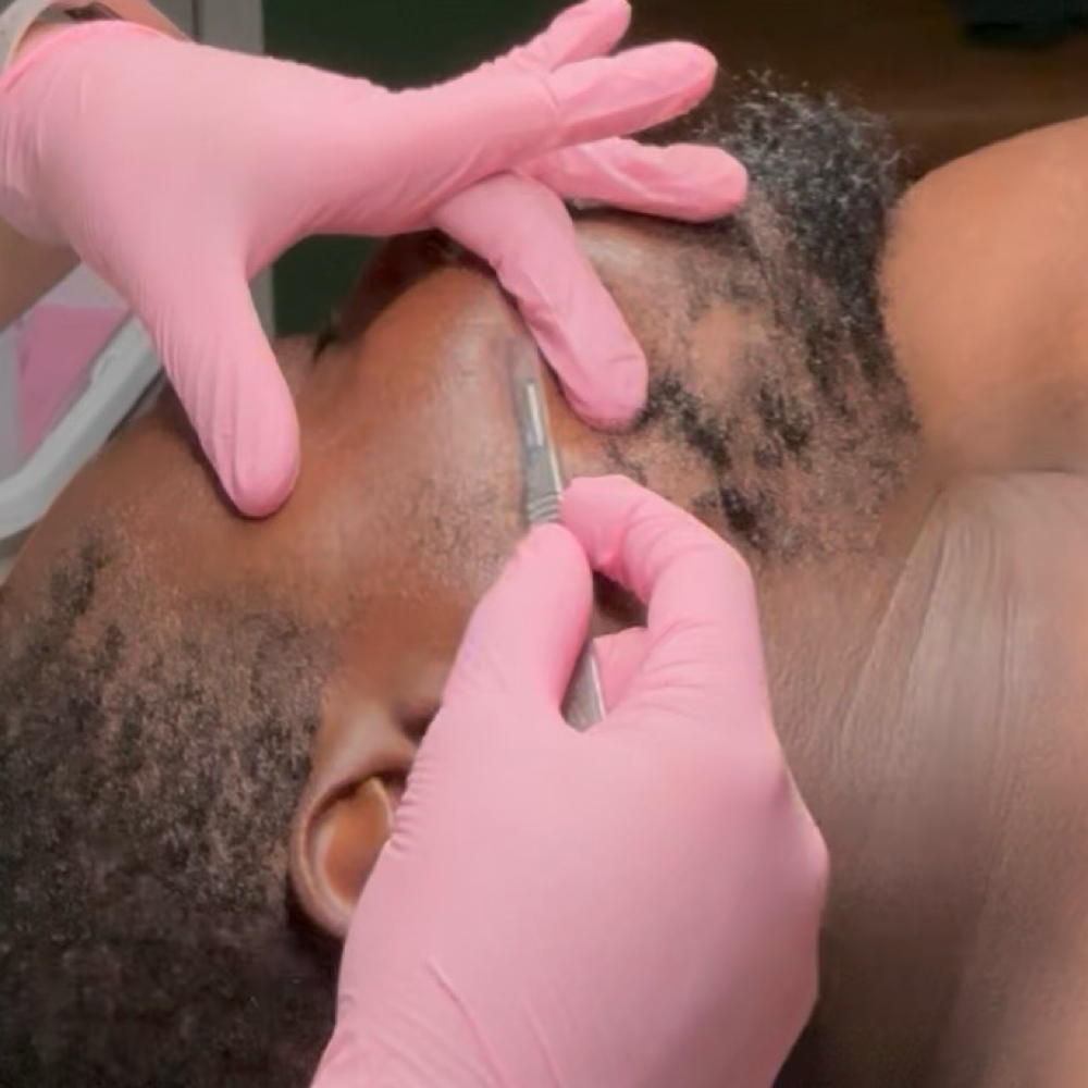 Social Media Dermaplane Facial at Massage-ology, LLC in AIken, SC