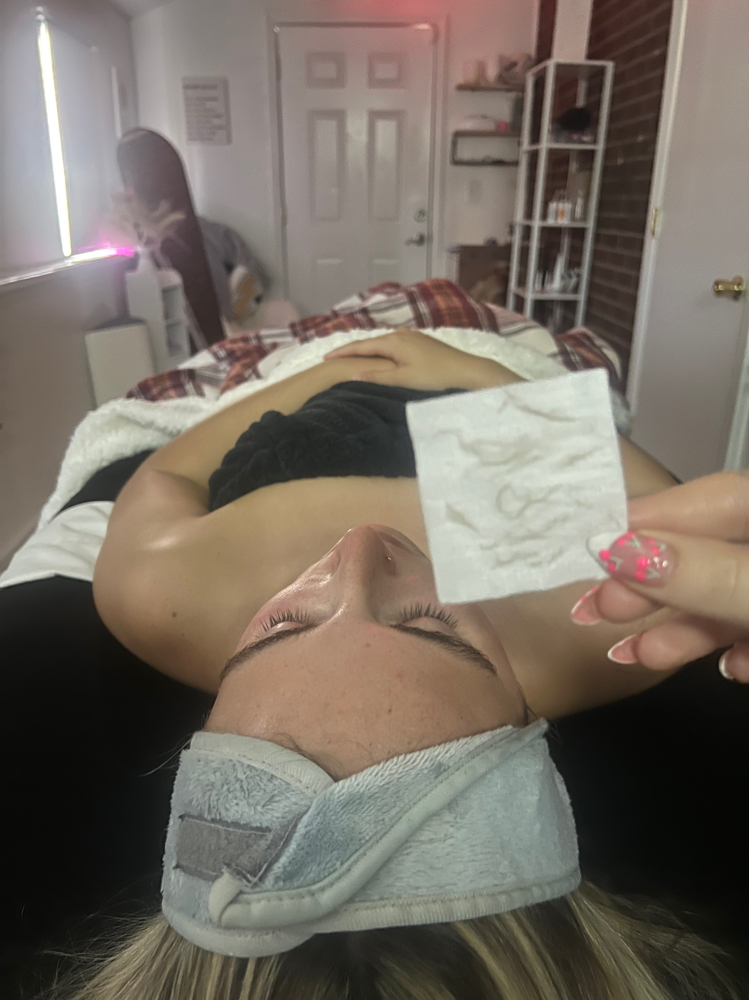 Dermaplane Facial